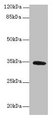 C5orf35 Antibody - Western blot All lanes: SETD9 antibody at 6µg/ml + K562 whole cell lysate Secondary Goat polyclonal to rabbit IgG at 1/10000 dilution Predicted band size: 35, 31 kDa Observed band size: 35 kDa