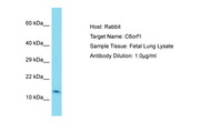 C6orf1 Antibody -  This image was taken for the unconjugated form of this product. Other forms have not been tested.
