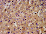 C6orf134 / ATAT1 Antibody - Immunohistochemistry image at a dilution of 1:300 and staining in paraffin-embedded human liver tissue performed on a Leica BondTM system. After dewaxing and hydration, antigen retrieval was mediated by high pressure in a citrate buffer (pH 6.0) . Section was blocked with 10% normal goat serum 30min at RT. Then primary antibody (1% BSA) was incubated at 4 °C overnight. The primary is detected by a biotinylated secondary antibody and visualized using an HRP conjugated SP system.