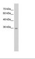 C6orf134 / ATAT1 Antibody - HepG2 Cell Lysate.  This image was taken for the unconjugated form of this product. Other forms have not been tested.