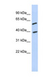C6orf146 Antibody - C6orf146 antibody Western blot of Jurkat lysate. This image was taken for the unconjugated form of this product. Other forms have not been tested.