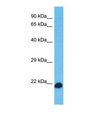 C6orf163 Antibody - Western blot of Human Jurkat. C6orf163 antibody dilution 1.0 ug/ml.  This image was taken for the unconjugated form of this product. Other forms have not been tested.