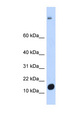 C6orf201 Antibody - C6orf201 antibody Western blot of Fetal Muscle lysate. This image was taken for the unconjugated form of this product. Other forms have not been tested.