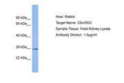 C6orf203 Antibody -  This image was taken for the unconjugated form of this product. Other forms have not been tested.