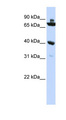 C7orf31 Antibody - C7orf31 antibody Western blot of HepG2 cell lysate. This image was taken for the unconjugated form of this product. Other forms have not been tested.