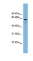 C7orf43 Antibody - C7orf43 antibody Western blot of HeLa lysate. This image was taken for the unconjugated form of this product. Other forms have not been tested.
