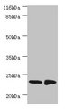 C7orf50 Antibody - Western blot All lanes: C7orf50 antibody at 2µg/ml Lane 1: A549 whole cell lysate Lane 2: MCF-7 whole cell lysate Secondary Goat polyclonal to rabbit IgG at 1/10000 dilution Predicted band size: 23 kDa Observed band size: 23 kDa