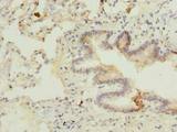 C7orf61 Antibody - Immunohistochemistry of paraffin-embedded human lung tissue using antibody at dilution of 1:100.