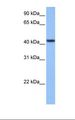 C8orf34 Antibody - Hela cell lysate. Antibody concentration: 1.0 ug/ml. Gel concentration: 12%.  This image was taken for the unconjugated form of this product. Other forms have not been tested.