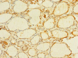 C8orf34 Antibody - Immunohistochemistry of paraffin-embedded human thyroid tissue using C8orf34 Antibody at dilution of 1:100