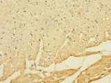 C8orf74 Antibody - Immunohistochemistry of paraffin-embedded human heart tissue using C8orf74 Antibody at dilution of 1:100
