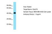 C8orf76 Antibody -  This image was taken for the unconjugated form of this product. Other forms have not been tested.