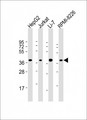 C9orf100 Antibody - All lanes: Anti-C9orf100 Antibody (Center) at 1:2000 dilution. Lane 1: HepG2 whole cell lysate. Lane 2: Jurkat whole cell lysate. Lane 3: Li-7 whole cell lysate. Lane 4: RPMI-8226 whole cell lysate Lysates/proteins at 20 ug per lane. Secondary Goat Anti-Rabbit IgG, (H+L), Peroxidase conjugated at 1:10000 dilution. Predicted band size: 38 kDa. Blocking/Dilution buffer: 5% NFDM/TBST.