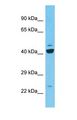 C9orf135 Antibody - Western blot of C9orf135 Antibody with human 786-0 Whole Cell lysate.  This image was taken for the unconjugated form of this product. Other forms have not been tested.