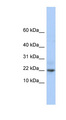 C9orf25 Antibody - C9orf25 antibody Western blot of Jurkat lysate. This image was taken for the unconjugated form of this product. Other forms have not been tested.