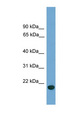 C9orf40 Antibody - C9orf40 antibody Western blot of Fetal Brain lysate. This image was taken for the unconjugated form of this product. Other forms have not been tested.