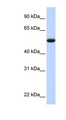 C9orf43 Antibody - C9orf43 antibody Western blot of Fetal Liver lysate. This image was taken for the unconjugated form of this product. Other forms have not been tested.