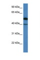 C9orf64 Antibody - C9orf64 antibody Western blot of COL0205 Cell lysate. Antibody concentration 1 ug/ml.  This image was taken for the unconjugated form of this product. Other forms have not been tested.