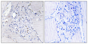 C9orf89 Antibody - Immunohistochemistry analysis of paraffin-embedded human thyroid gland tissue, using C9orf89 Antibody. The picture on the right is blocked with the synthesized peptide.