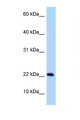 C9orf9 Antibody - C9orf9 antibody Western blot of Rat Muscle lysate. Antibody concentration 1 ug/ml.  This image was taken for the unconjugated form of this product. Other forms have not been tested.