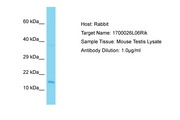 C9orf9 Antibody -  This image was taken for the unconjugated form of this product. Other forms have not been tested.