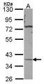 CA11 / Carbonic Anhydrase XI Antibody - Sample (30 ug of whole cell lysate). A: A431 . 10% SDS PAGE. Carbonic Anhydrase XI / CA11 antibody diluted at 1:500.