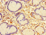 CA11 / Carbonic Anhydrase XI Antibody - Immunohistochemistry of paraffin-embedded human stomach tissue using CA11 Antibody at dilution of 1:100