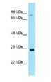 CA13 / Carbonic Anhydrase XIII Antibody - CA13 / Carbonic Anhydrase XIII antibody Western Blot of THP-1.  This image was taken for the unconjugated form of this product. Other forms have not been tested.