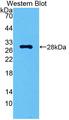 CA2 / Carbonic Anhydrase II Antibody - Western Blot; Sample: Recombinant protein.