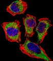CA2 / Carbonic Anhydrase II Antibody - Fluorescent confocal image of HeLa cell stained with CA2 Antibody. HeLa cells were fixed with 4% PFA (20 min), permeabilized with Triton X-100 (0.1%, 10 min), then incubated with CA2 primary antibody (1:25, 1 h at 37°C). For secondary antibody, Alexa Fluor 488 conjugated donkey anti-rabbit antibody (green) was used (1:400, 50 min at 37°C). Cytoplasmic actin was counterstained with Alexa Fluor 555 (red) conjugated Phalloidin (7units/ml, 1 h at 37°C). Nuclei were counterstained with DAPI (blue) (10 ug/ml, 10 min). CA2 immunoreactivity is localized to Cytoplasm significantly.
