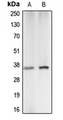 CA5A / Carbonic Anhydrase VA Antibody - Western blot analysis of Carbonic Anhydrase 5A expression in K562 (A); A549 (B) whole cell lysates.