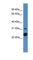 CA7 / Carbonic Anhydrase VII Antibody - CA7 / Carbonic Anhydrase VII antibody Western blot of Fetal Brain lysate.  This image was taken for the unconjugated form of this product. Other forms have not been tested.