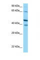 CABP / CABP1 Antibody - CABP1 antibody Western blot of Jurkat Cell lysate. Antibody concentration 1 ug/ml.  This image was taken for the unconjugated form of this product. Other forms have not been tested.