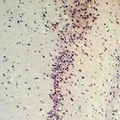 CABP2 Antibody - Immunohistochemical analysis of CABP2 staining in rat brain formalin fixed paraffin embedded tissue section. The section was pre-treated using heat mediated antigen retrieval with sodium citrate buffer (pH 6.0). The section was then incubated with the antibody at room temperature and detected using an HRP conjugated compact polymer system. DAB was used as the chromogen. The section was then counterstained with hematoxylin and mounted with DPX.