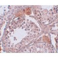 CABS1 Antibody - Immunohistochemistry of CLPH in human testis tissue with CLPH antibody at 5 µg/mL.