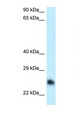 CABYR Antibody - CABYR antibody Western blot of HepG2 Cell lysate. Antibody concentration 1 ug/ml.  This image was taken for the unconjugated form of this product. Other forms have not been tested.
