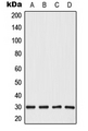 CABYR Antibody - Western blot analysis of CBP86 expression in HepG2 (A); HeLa (B); SP2/0 (C); PC12 (D) whole cell lysates.