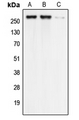CACNA1G / Cav3.1 Antibody - Western blot analysis of Cav3.1 expression in HEK293T (A); Raw264.7 (B); H9C2 (C) whole cell lysates.
