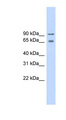 CACNB2 Antibody - CACNB2 antibody Western blot of Fetal lung lysate. This image was taken for the unconjugated form of this product. Other forms have not been tested.