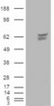 CACNB4 Antibody - HEK293 overexpressing CACNB4 (RC210440) and probed with (mock transfection in first lane).