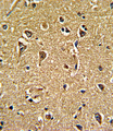 CACNG5 Antibody - Formalin-fixed and paraffin-embedded human brain tissue reacted with CACNG5 Antibody , which was peroxidase-conjugated to the secondary antibody, followed by DAB staining. This data demonstrates the use of this antibody for immunohistochemistry; clinical relevance has not been evaluated.
