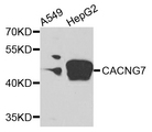 CACNG7 Antibody - Western blot analysis of extracts of various cells.