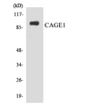 CAGE1 / Cancer Antigen 1 Antibody - Western blot analysis of the lysates from HepG2 cells using CAGE1 antibody.