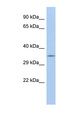 CALB2 / Calretinin Antibody - CALB2 / Calretinin antibody Western blot of MCF7 cell lysate. This image was taken for the unconjugated form of this product. Other forms have not been tested.