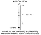 CALB2 / Calretinin Antibody
