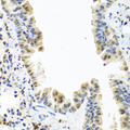 CALCB Antibody - Immunohistochemistry of paraffin-embedded mouse lung tissue.