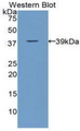 Calcitonin Antibody - Western blot of recombinant CGRP / Calcitonin.  This image was taken for the unconjugated form of this product. Other forms have not been tested.