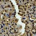 CALCOCO1 / CoCoa Antibody - Immunohistochemical analysis of CALCOCO1 staining in human kidney formalin fixed paraffin embedded tissue section. The section was pre-treated using heat mediated antigen retrieval with sodium citrate buffer (pH 6.0). The section was then incubated with the antibody at room temperature and detected using an HRP conjugated compact polymer system. DAB was used as the chromogen. The section was then counterstained with hematoxylin and mounted with DPX.