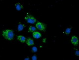 CALCOCO2 Antibody - Anti-CALCOCO2 mouse monoclonal antibody immunofluorescent staining of COS7 cells transiently transfected by pCMV6-ENTRY CALCOCO2.