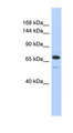 CALD1 / Caldesmon Antibody - CALD1 / Caldesmon antibody Western blot of Transfected 293T cell lysate. This image was taken for the unconjugated form of this product. Other forms have not been tested.